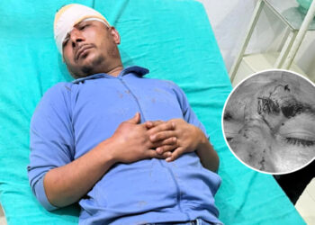बैतडीमा एमाले–रास्वपा कार्यकर्ताबीच झडप, एमालेका दुई कार्यकर्ता घाइते